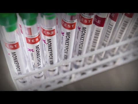 CDC warns of possible resurgence of mpox this summer