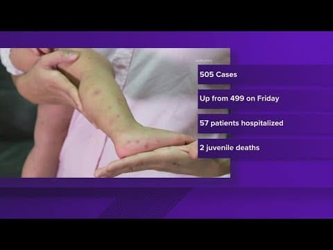 Number of measles case in Texas surpasses 500, new health department data shows
