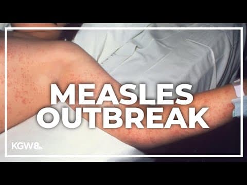 Oregon health officials declare a measles outbreak