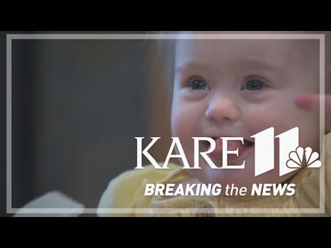 1-year-old Shakopee girl is first in country to receive heart device