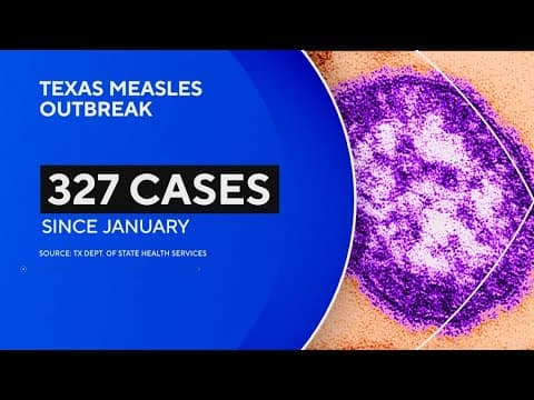 Measles outbreak points to concerning post-pandemic vaccination trend