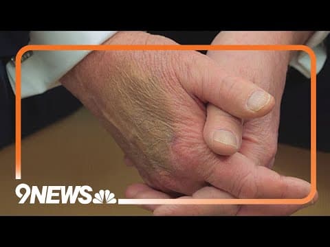 How will vein disorder impact President Trump's health?