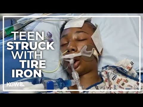 13-year-old hospitalized after being struck with tire iron in SE Portland