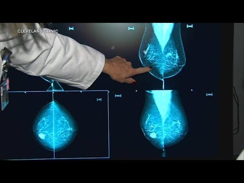 Young women are being diagnosed with breast cancer, here is what doctors say