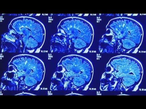 More heat means more headaches, here's how to avoid them