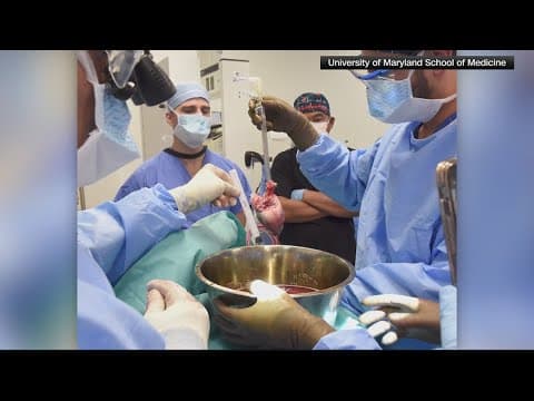 Maryland man dies after getting second pig heart transplant