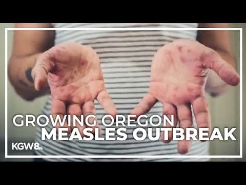 Doctors issue warning about spread of measles in Oregon