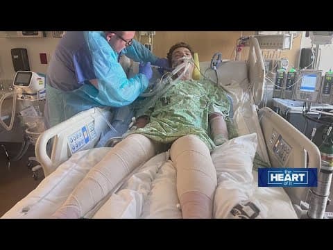 Teen burn victim gets a second chance at life | The Heart Of It