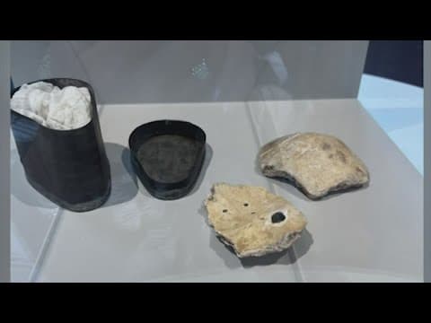 Parts of Beethoven's skull donated to Medical University of Vienna