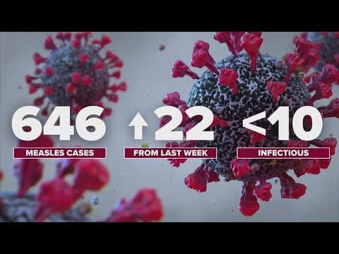 Measles outbreak in West Texas grows to nearly 650 cases