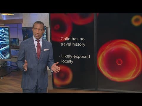 Harris County health department reports measles case in child younger than 18