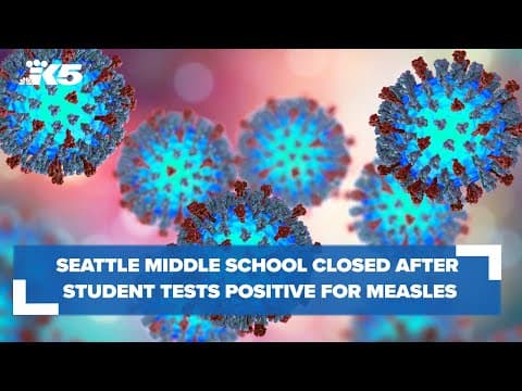 Seattle middle school closed after student tests positive for measles