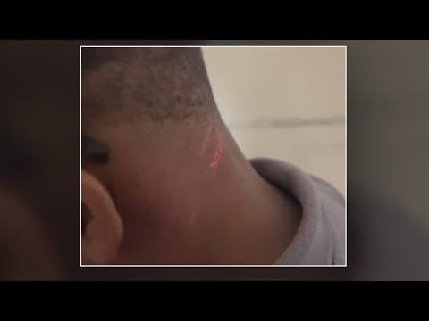 Mother seeks answers after special needs child injured on school bus