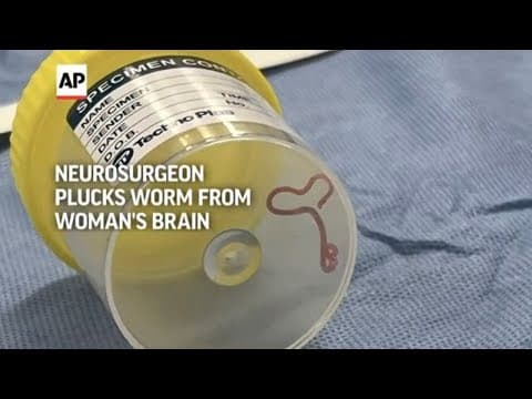 Neurosurgeon plucks worm from woman's brain in Australia