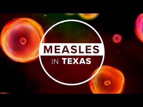 Measles has long incubation period