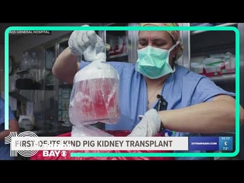 US surgeons transplant a gene-edited pig kidney into a patient for the first time