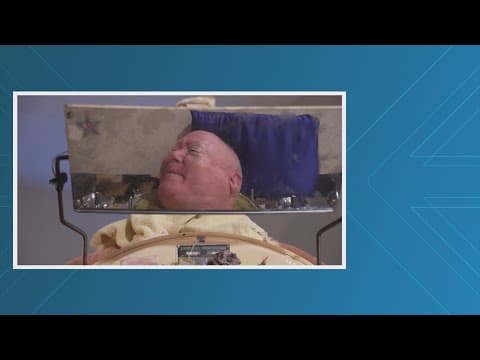 Dallas man who lived in an iron lung for 70-plus years has died