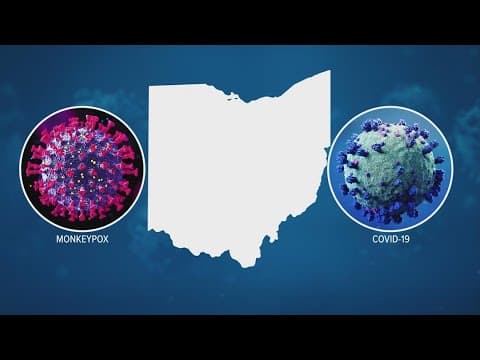 OhioHealth doctor discusses spread of new COVID-19 subvariant, Monkeypox