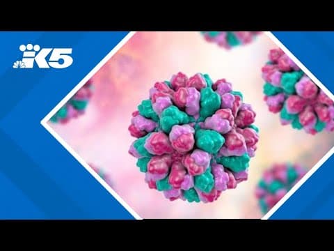 Suspected norovirus outbreak in Gig Harbor