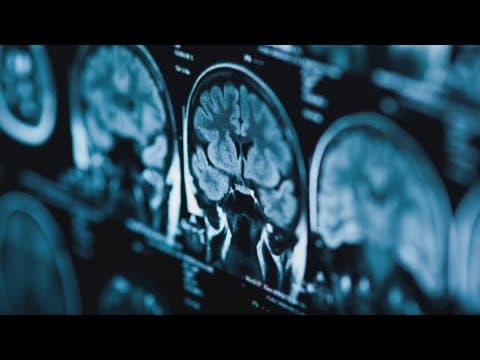 Impact of heat on your brain