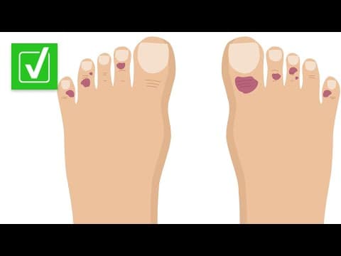 Yes, COVID toes are a real condition