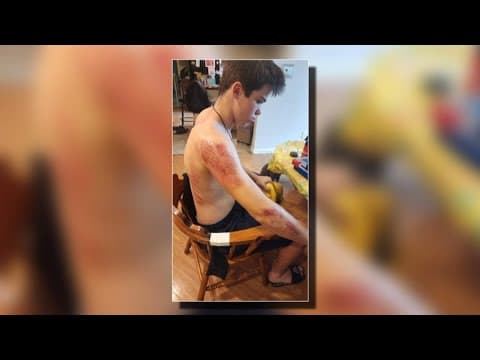 Lebanon teen dropped off at home by driver who struck him