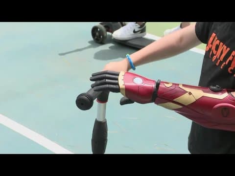 Meet the youngest recipient of a bionic arm