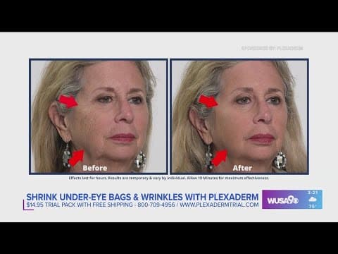 How to shrink under-eye bags and wrinkles with Plexaderm