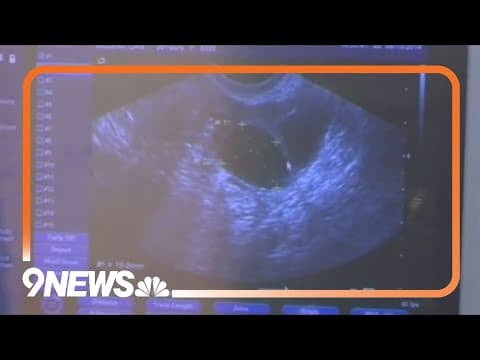 Texas man suing former partner for coming to Colorado to get an abortion, WaPo reports