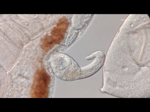 Parasitic 'zombie snails' found at popular San Diego County lake