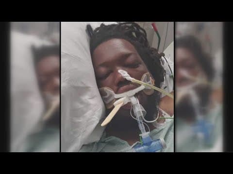 "His whole midsection ... came open" | Mother calls on driver who hit her son to come forward
