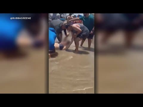 Two bitten by sharks at South Padre Island