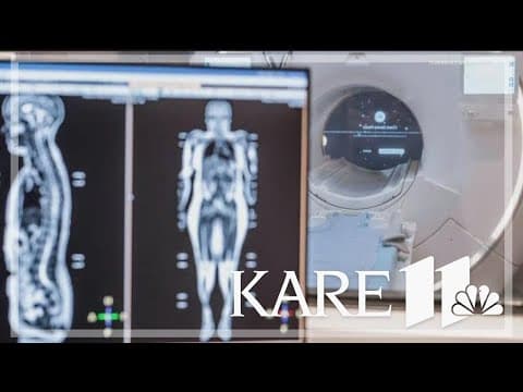 Full body scans: Why some doctors have concerns