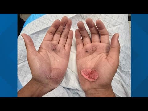 Students injured at East Texas middle school after doing TikTok 'bear crawl' challenge