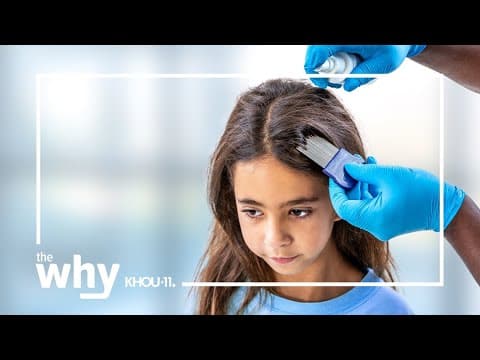 Why is the CDC changing the rules when it comes to lice in schools?