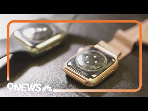 Smartwatch bands can contain elevated levels of bacteria, study shows