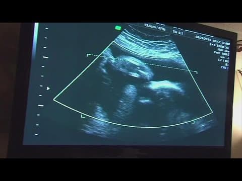 Court documents reveal 2 more Ohio minors who were abused left the state for abortions