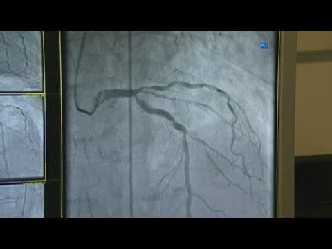 Routine screening finds collapsed lung