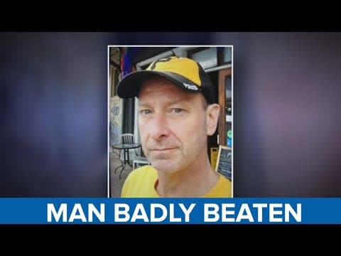 Man fighting for life after beating when he accidentally steps on someone's shoes