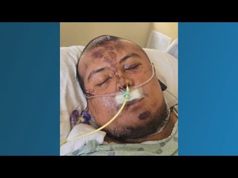 Teen remains hospitalized weeks after serious ATV accident in northeast Harris County