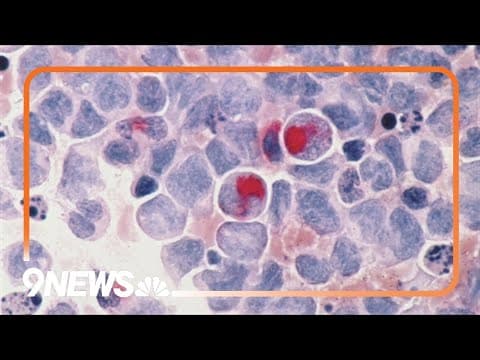 New study says traces of ancient viruses are in our DNA may play a role in modern day cancers