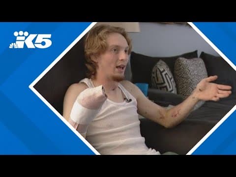 Washington teen loses hand in fireworks accident while protecting young kids