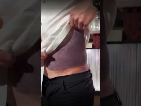 Gordon Ramsay shares huge bruise after bicycle accident