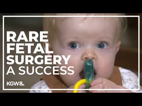Oregon baby is the second person to get a brand-new kind of fetal surgery to treat spina bifida