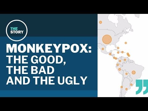 Monkeypox: The good news and bad news about this latest global health emergency