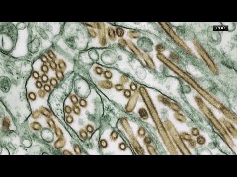 Experts warn of bird flu mutation after first severe U.S. case in Louisiana