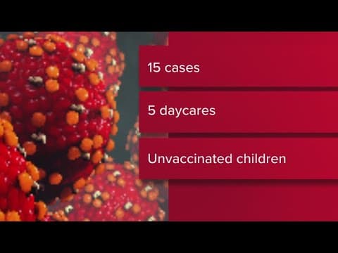 Health officials investigating 15 measles cases at 5 Columbus-area child care facilities