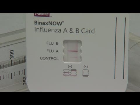 Flu cases are on the rise. Here are the symptoms to look out for
