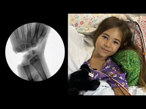 9-year-old girl has hand reattached after shark attack