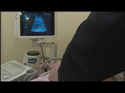 Judge temporarily blocks abortion law in Ohio